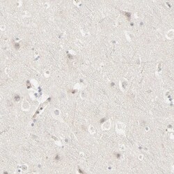 Galectin-2 Antibody, Novus Biologicals 0.1mL; Unlabeled:Antibodies, Polyclonal